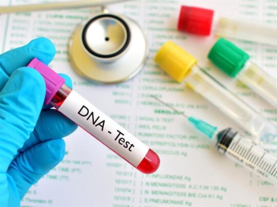 DNA testi nedir? Nasıl yapılır?