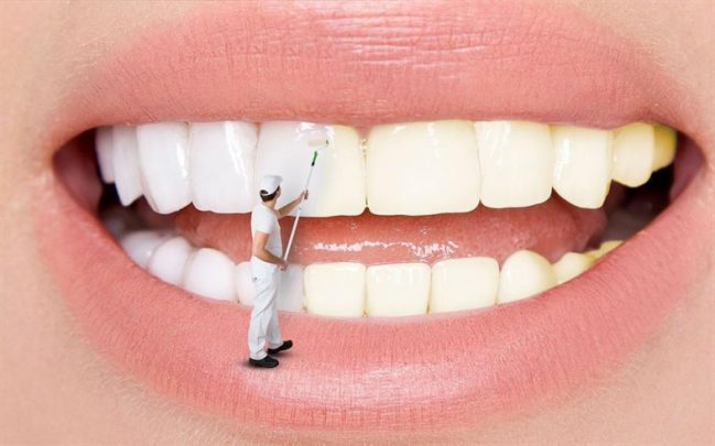  Diş Beyazlatma Kalemleri Faydalı Mıdır?