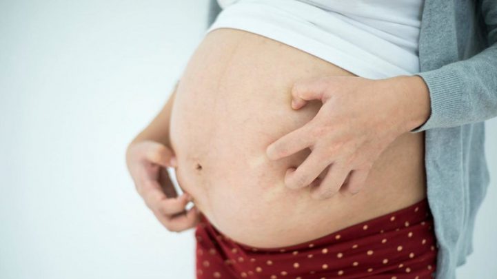 Hamilelikte Ciltte Oluşan 8 Değişiklik