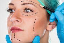 lipofilling yag enjeksiyonu nedir nasil yapilir2