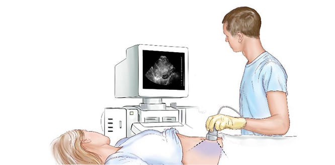 gebelikte ayrintili ultrason nedir kacinci haftada yapilir2