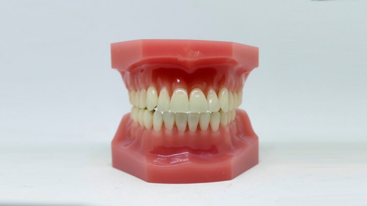 Şeffaf Plak Tedavisi Nedir? Çarpık Diş Tedavisi