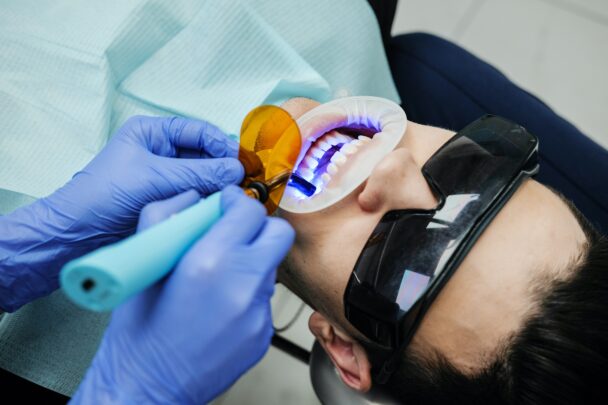 Şeffaf Plak Tedavisi Nedir? Çarpık Diş Tedavisi