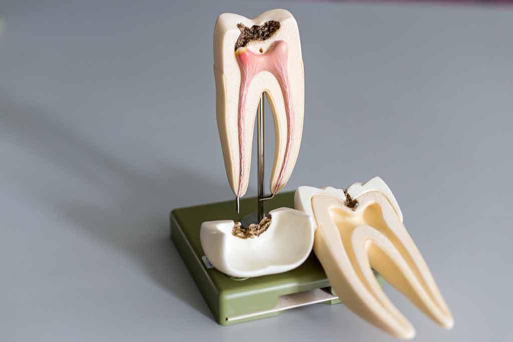 Endodontik 