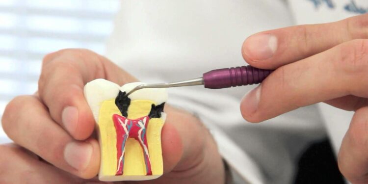 Endodonti