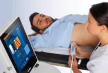 fibroscan nedir faydalari nelerdir1