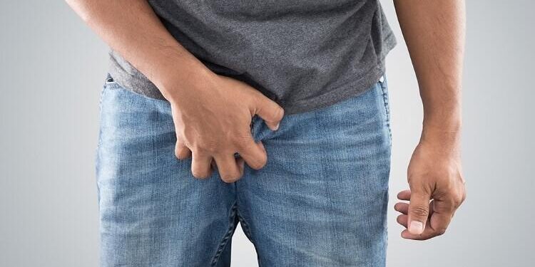 orsit nedir turleri nelerdir3