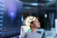 neurofeedback nedir 1