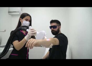 erkek lazer epilasyon