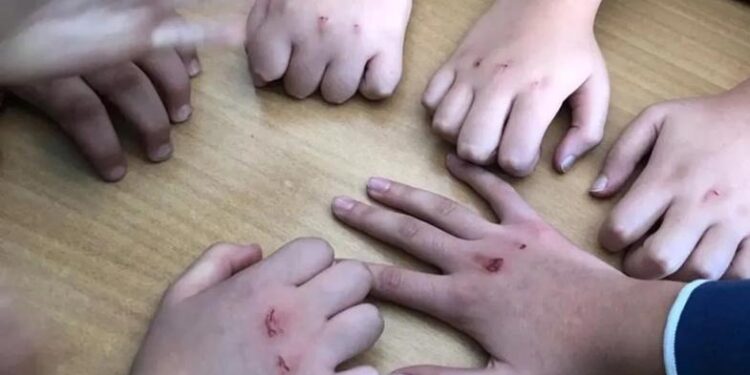 kanli para oyunu nedir 1