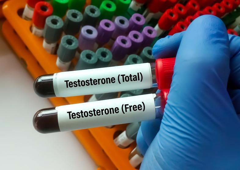 Testosteron Nasıl Artırılır?