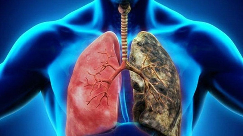 Çoklu Organ Yetmezliği Nedir? Belirtileri ve Tedavi Yöntemleri Neler? 3 coklu organ yetmezligi nedir 2