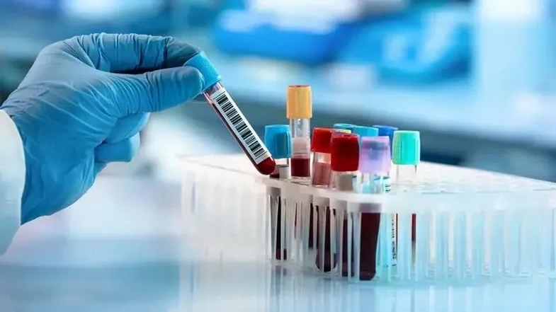 Uyuşturucu Testi Nasıl Yapılır? 7 Kritik Adım 2 Uyuşturucu Testi
