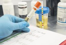 Uyuşturucu Testi Nasıl Yapılır? 7 Kritik Adım 42 uyusturucu testi nasil yapilir 4