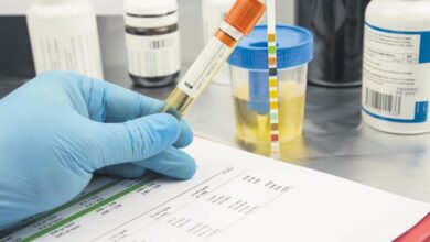Uyuşturucu Testi Nasıl Yapılır? 7 Kritik Adım 42 uyusturucu testi nasil yapilir 4