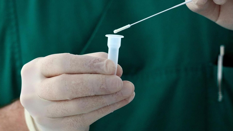 Uyuşturucu Testi Nasıl Yapılır? 7 Kritik Adım 4 uyusturucu testi nasil yapilir 7