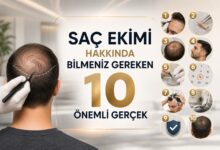 Buyuk maksatbilgi.com Sac Ekimi Hakkinda Bilmeniz Gereken 10 Onemli Gercek
